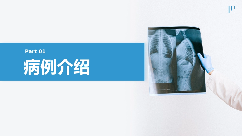 肺部感染的个案护理_第3页