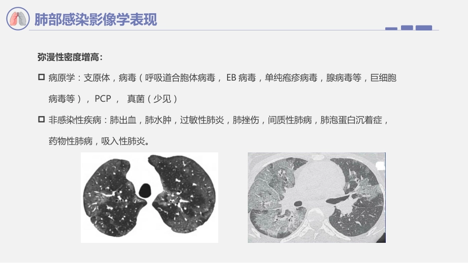 肺部感染影像学表现_第15页