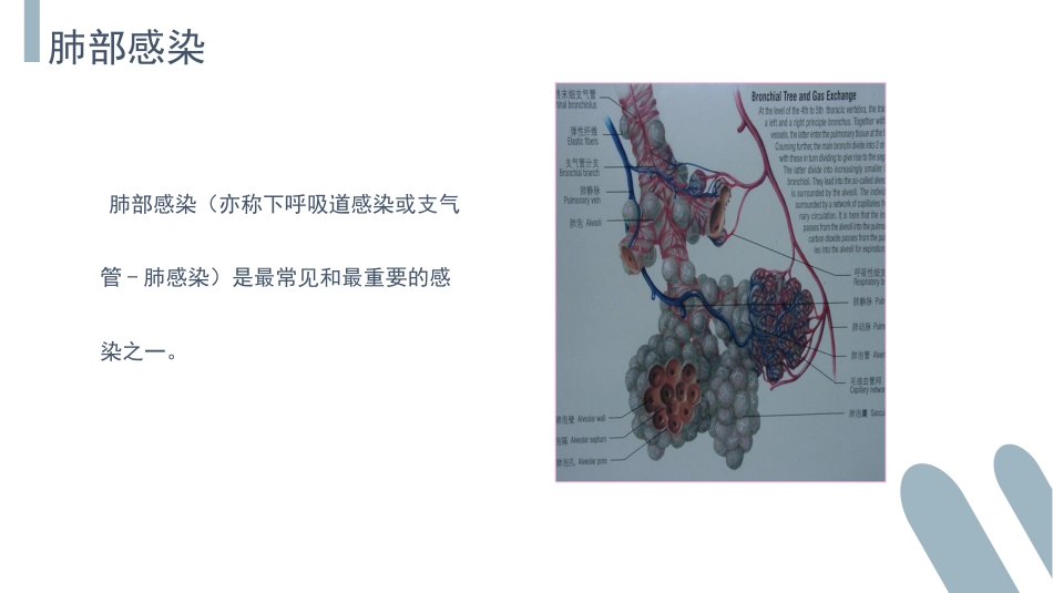 肺部感染介绍_第4页