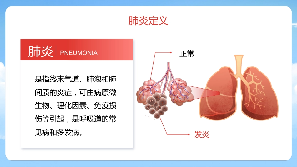 肺炎护理1_第5页
