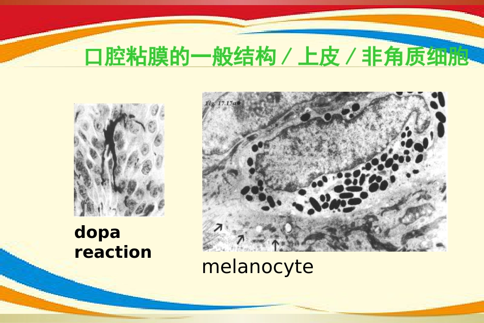 《口腔黏膜病》PPT课件_第13页