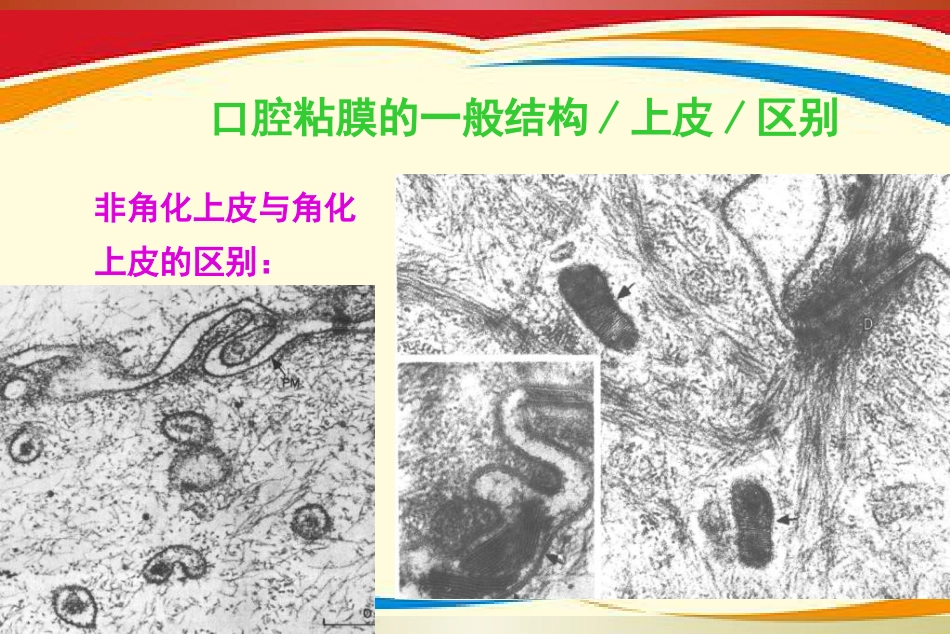 《口腔黏膜病》PPT课件_第9页