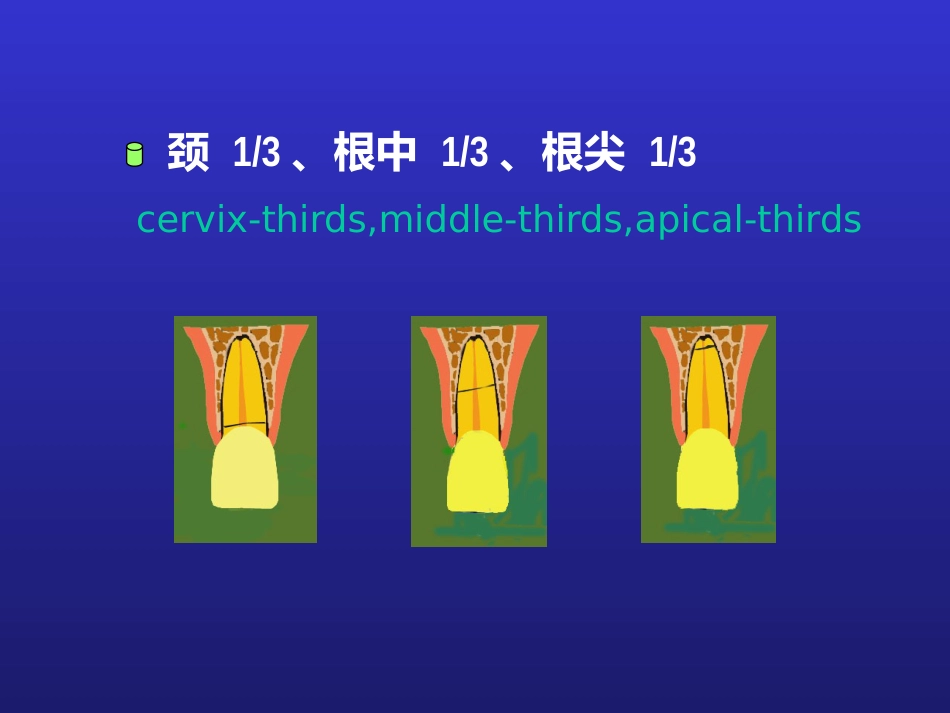 【口腔医学】牙折的病因及治疗方法PPT_第8页