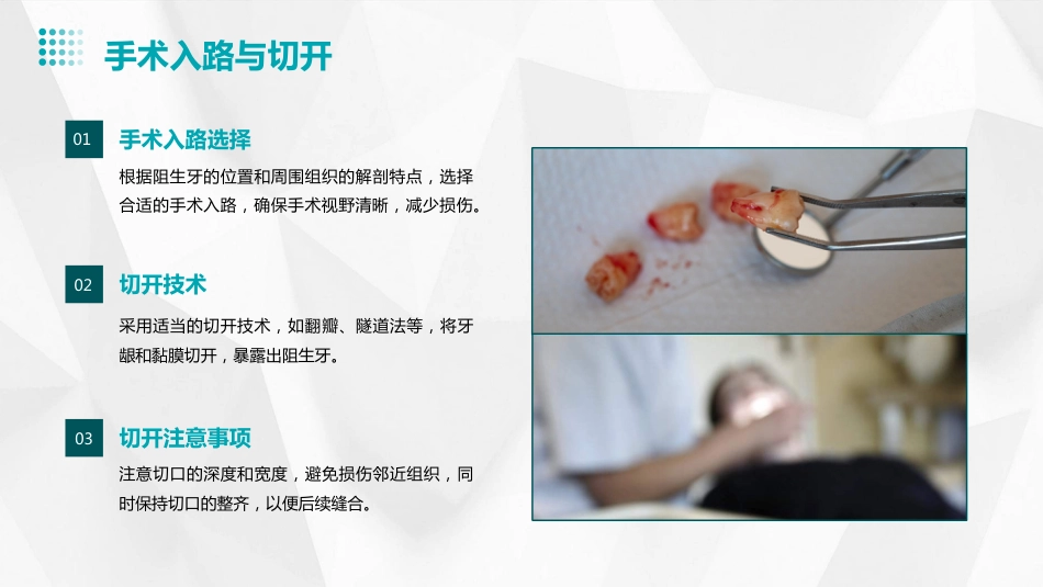 《口腔颌面外科学》阻生牙拔除ppt课件_第12页