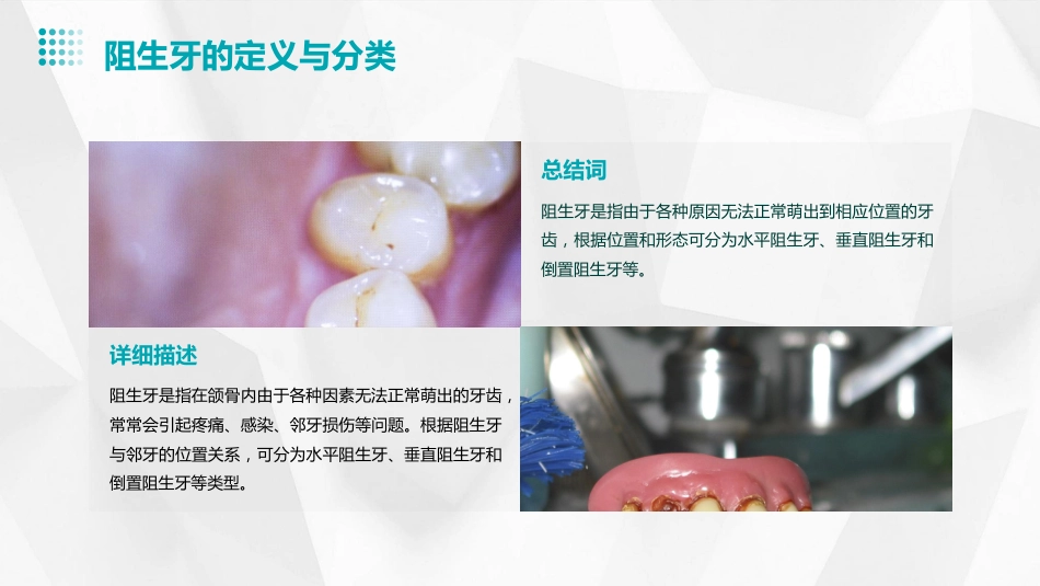 《口腔颌面外科学》阻生牙拔除ppt课件_第4页