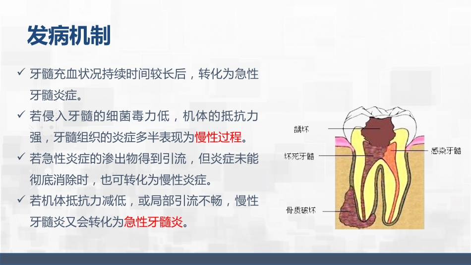 牙髓炎护理查房_第10页