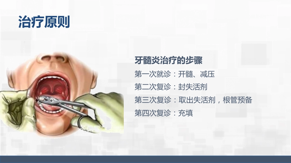 牙髓炎护理查房_第13页