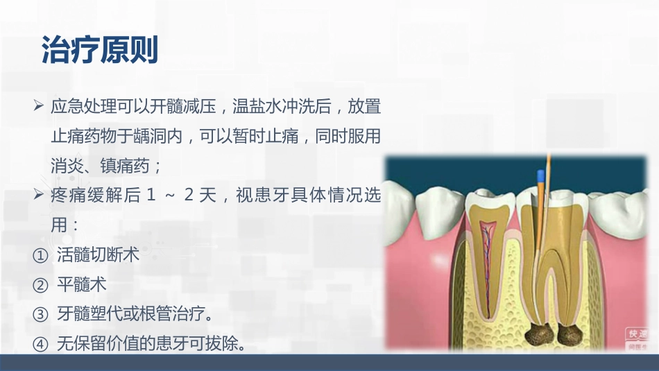 牙髓炎护理查房_第14页