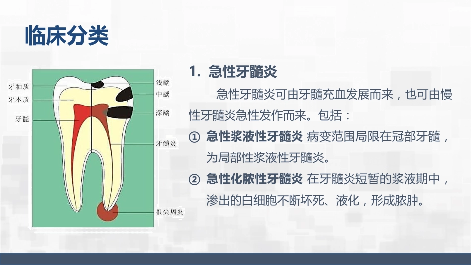 牙髓炎护理查房_第5页