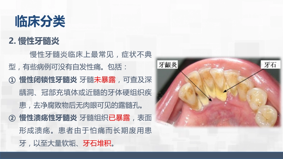 牙髓炎护理查房_第6页