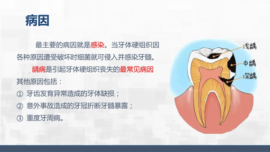 牙髓炎护理查房_第8页