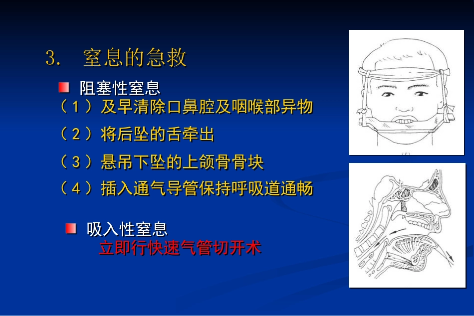【口腔医学】口腔颌面部损伤_第14页