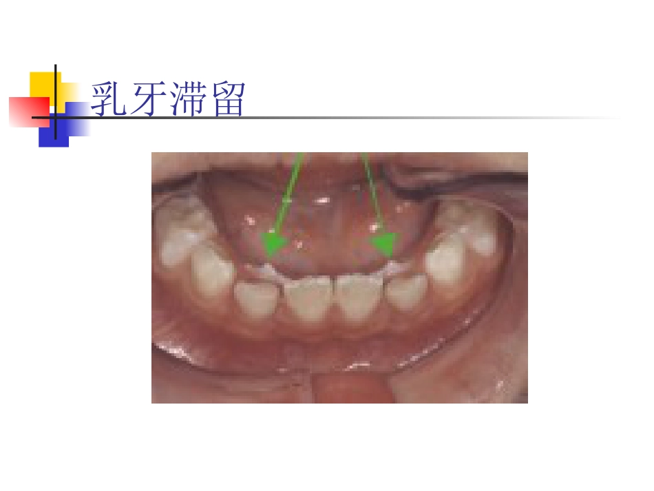 拔牙_第10页