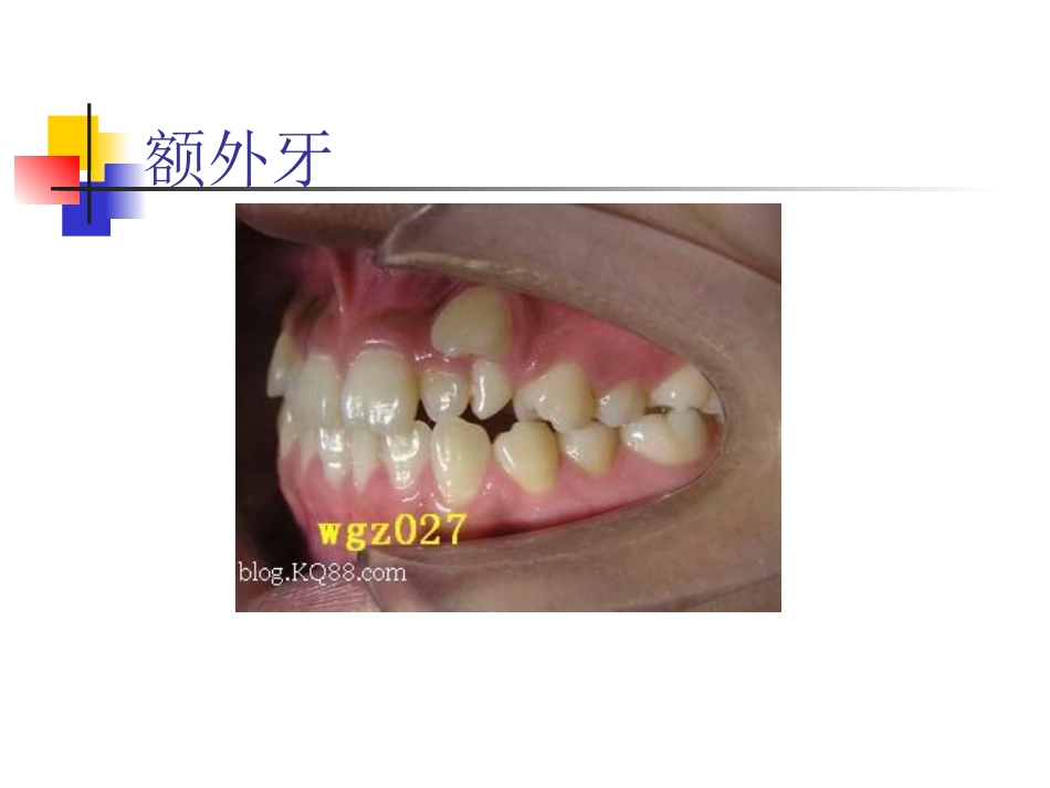拔牙_第7页