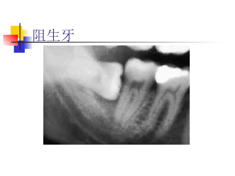 拔牙_第9页