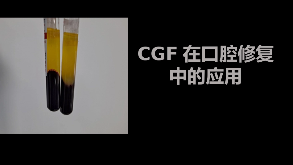 CGF在口腔修复中的应用_第1页