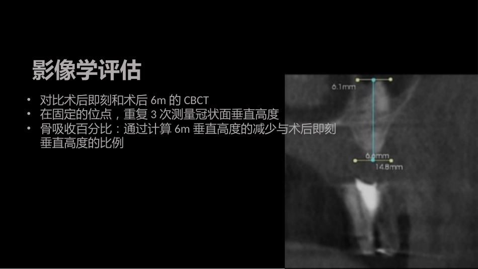 CGF在口腔修复中的应用_第15页
