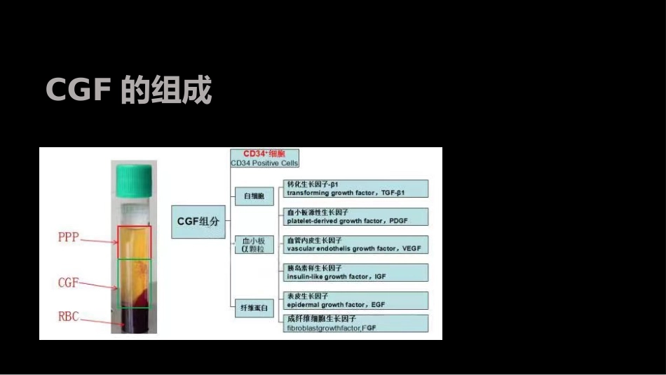 CGF在口腔修复中的应用_第4页