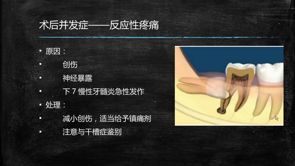 拔牙术中术后并发症的处理_第14页