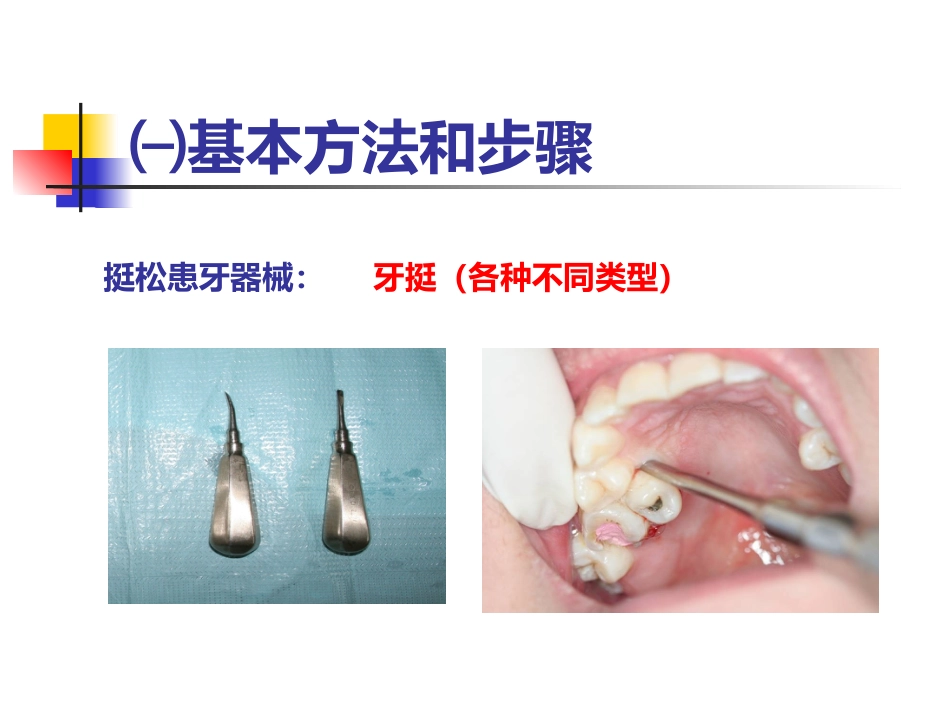 拔牙术_第11页