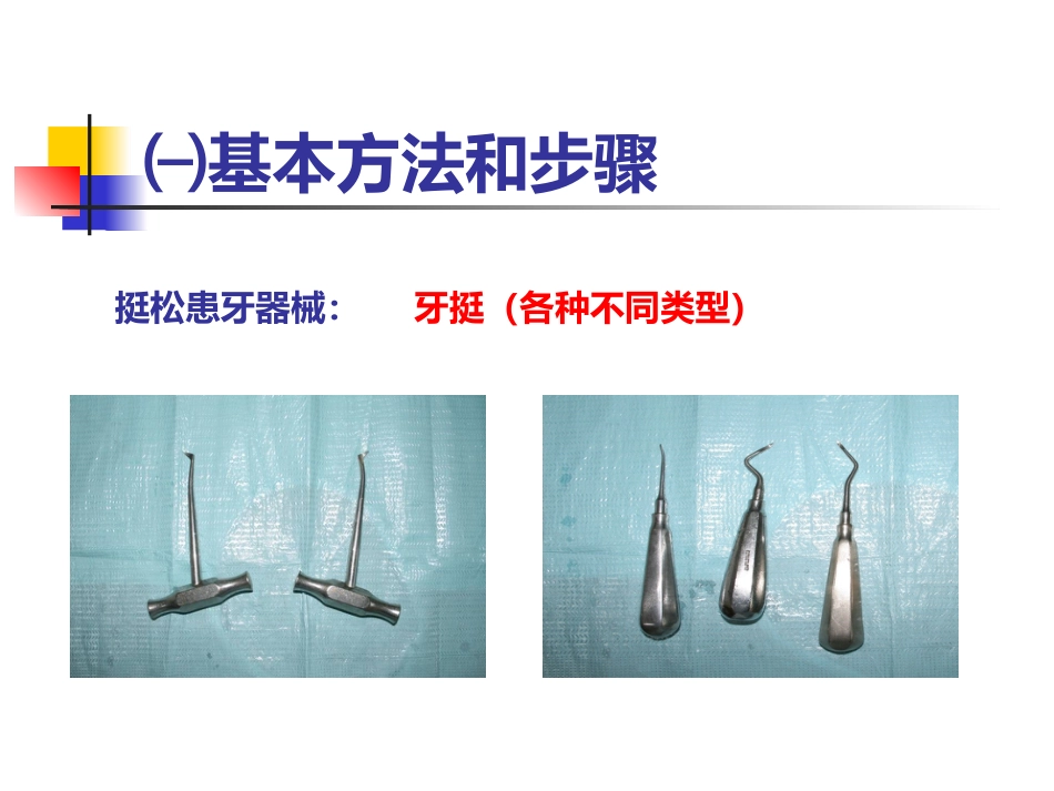 拔牙术_第12页