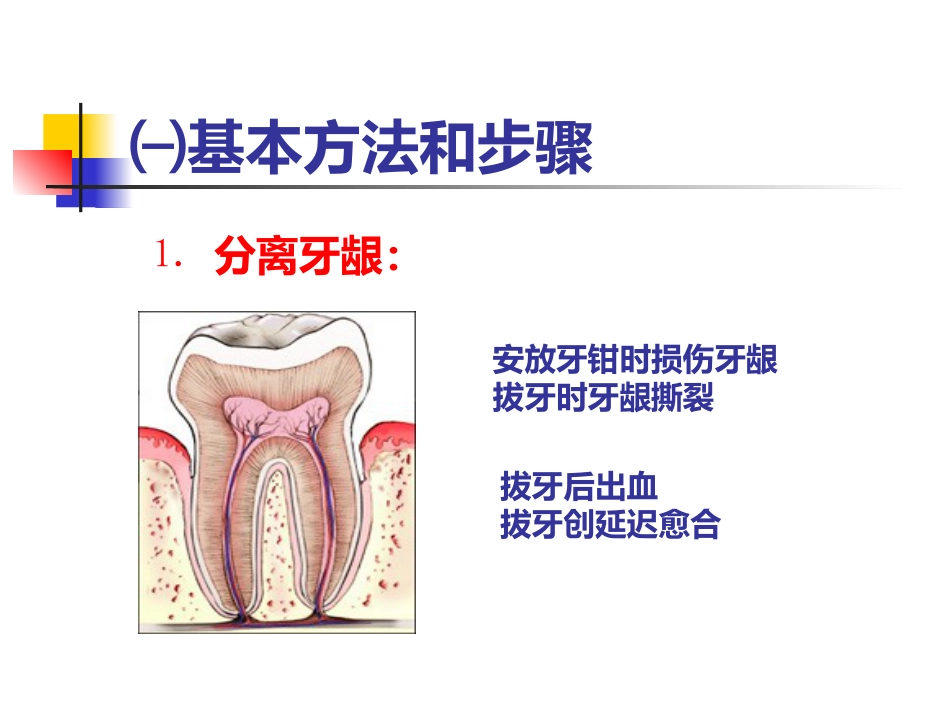 拔牙术_第5页
