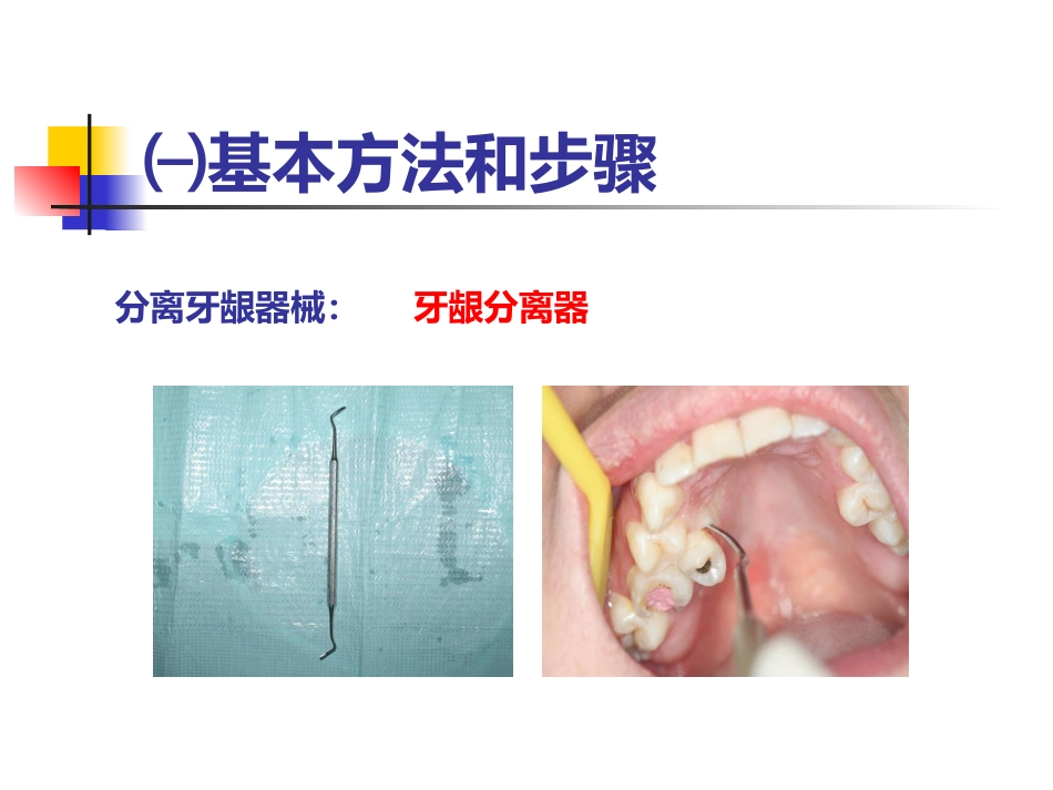 拔牙术_第6页