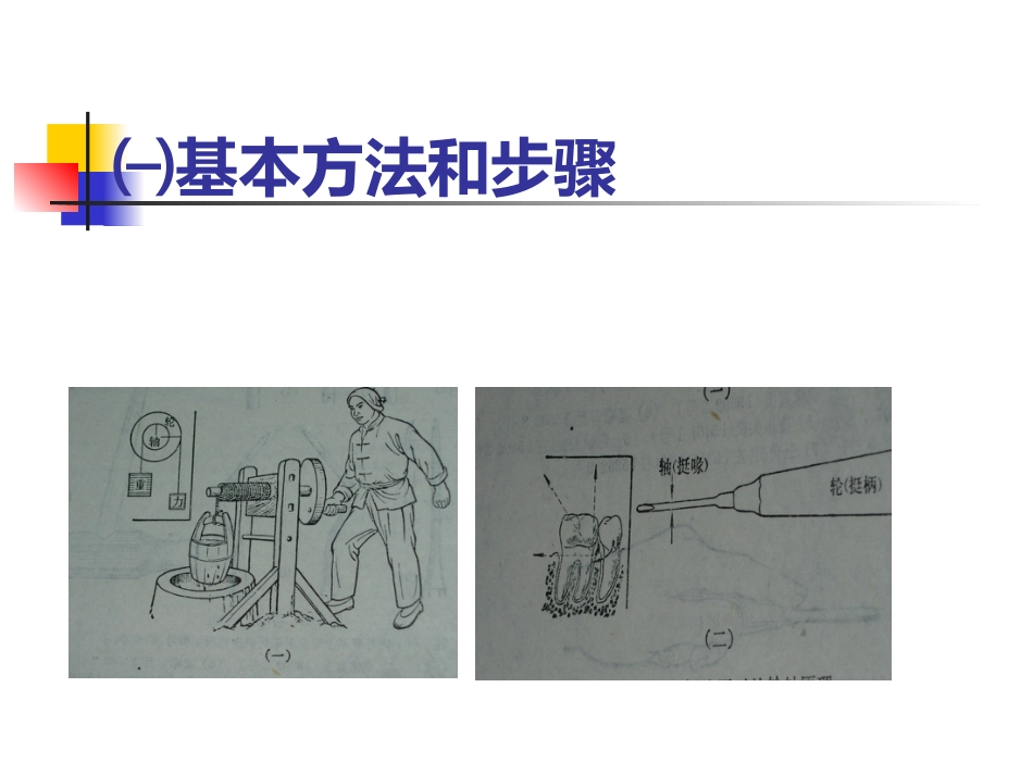 拔牙术_第9页