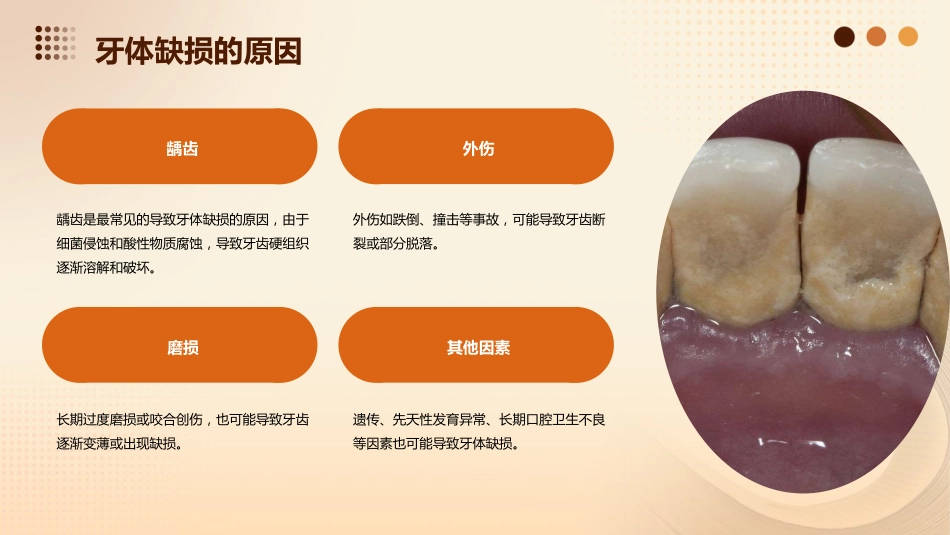 《牙体缺损修复》课件_第5页