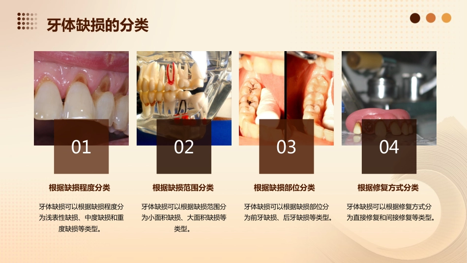 《牙体缺损修复》课件_第6页