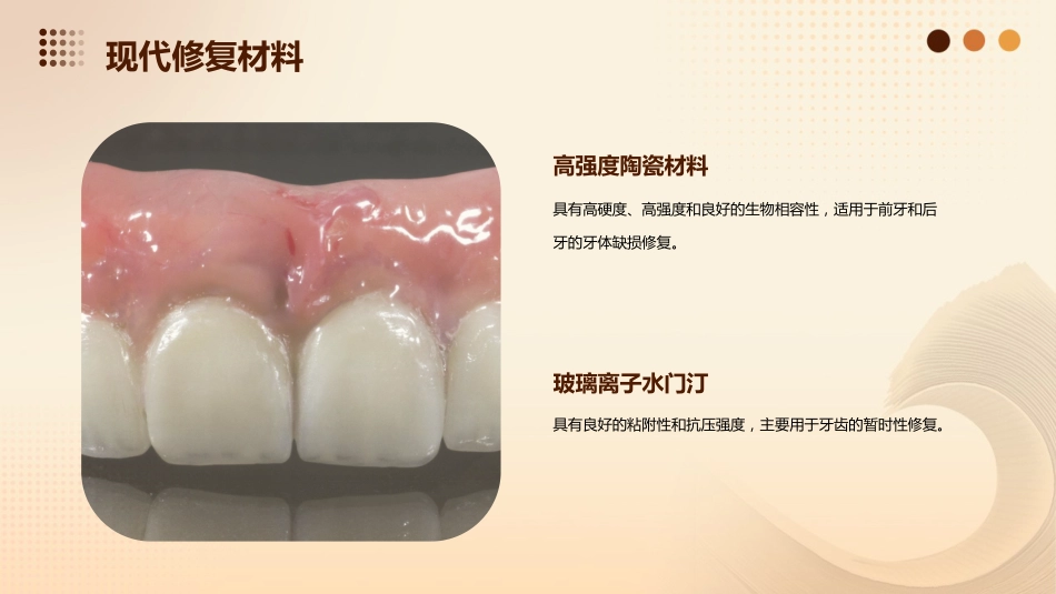 《牙体缺损修复》课件_第9页