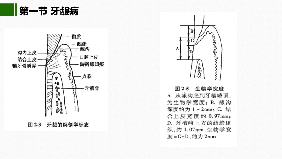 2020年高校课件口腔医学牙周疾病_第3页