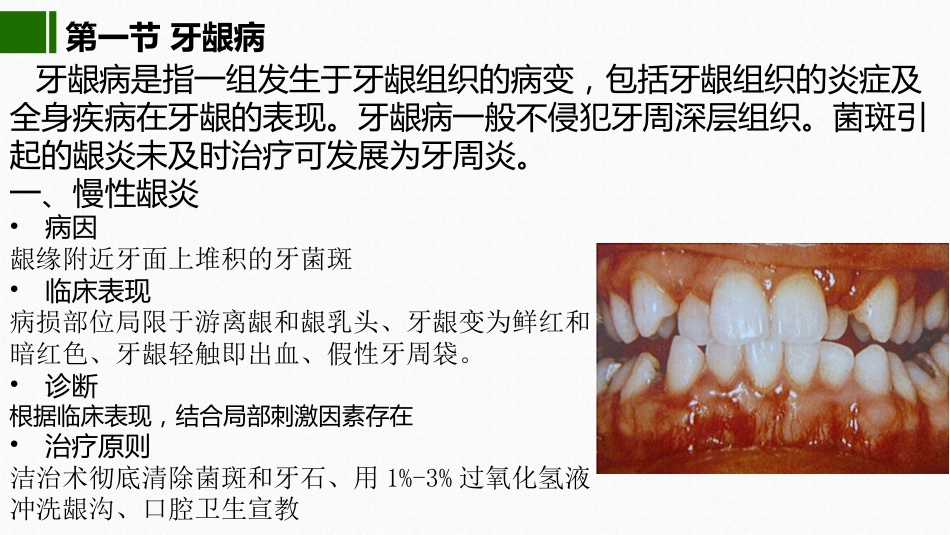2020年高校课件口腔医学牙周疾病_第5页