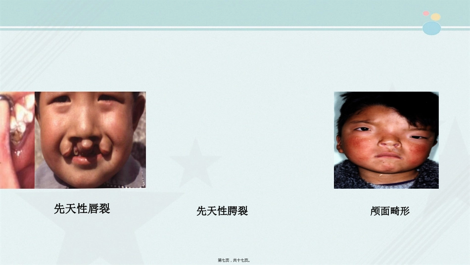 2021口腔医学专业《口腔颌面美容外科》_第8页