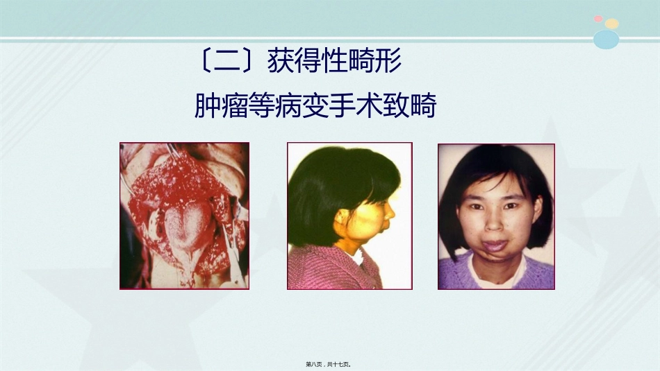 2021口腔医学专业《口腔颌面美容外科》_第9页