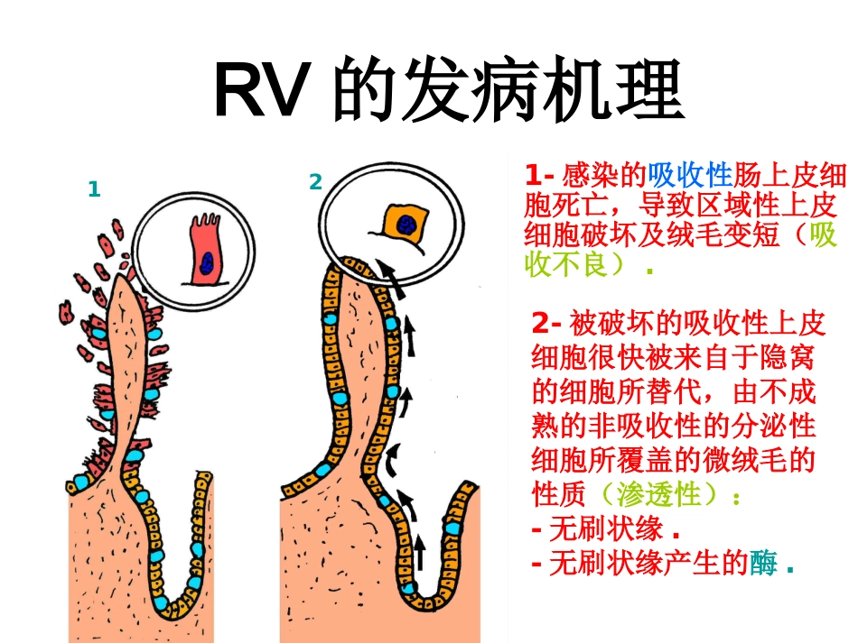 轮状病毒性肠炎 ppt课件【52页】_第11页