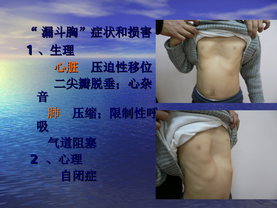 外科-胸  壁  疾  病_第7页