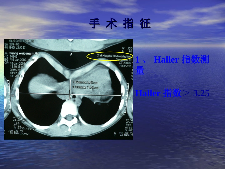 外科-胸  壁  疾  病_第9页