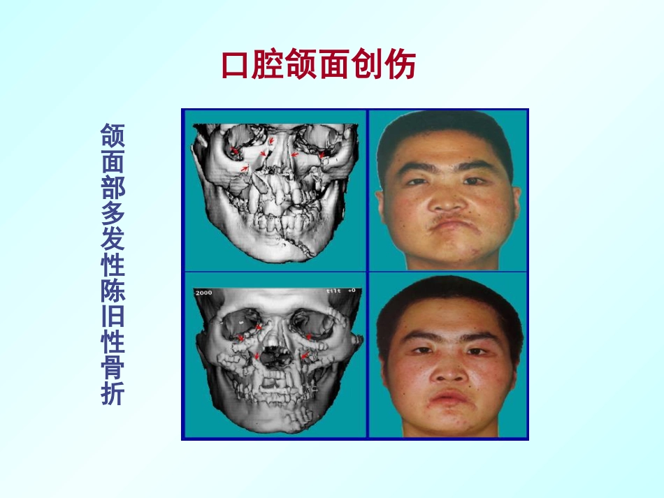 口腔颌面外科学绪论_第10页