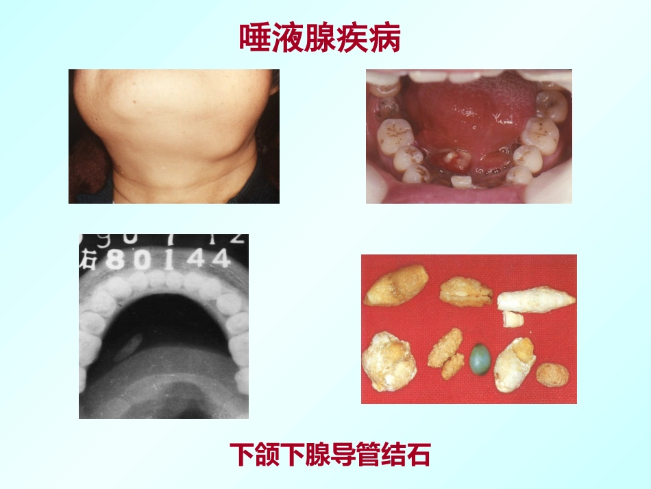 口腔颌面外科学绪论_第11页