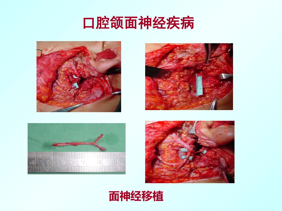 口腔颌面外科学绪论_第12页