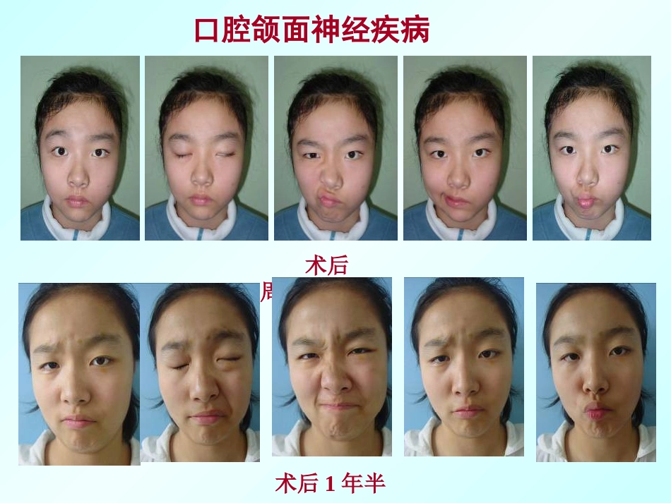口腔颌面外科学绪论_第13页