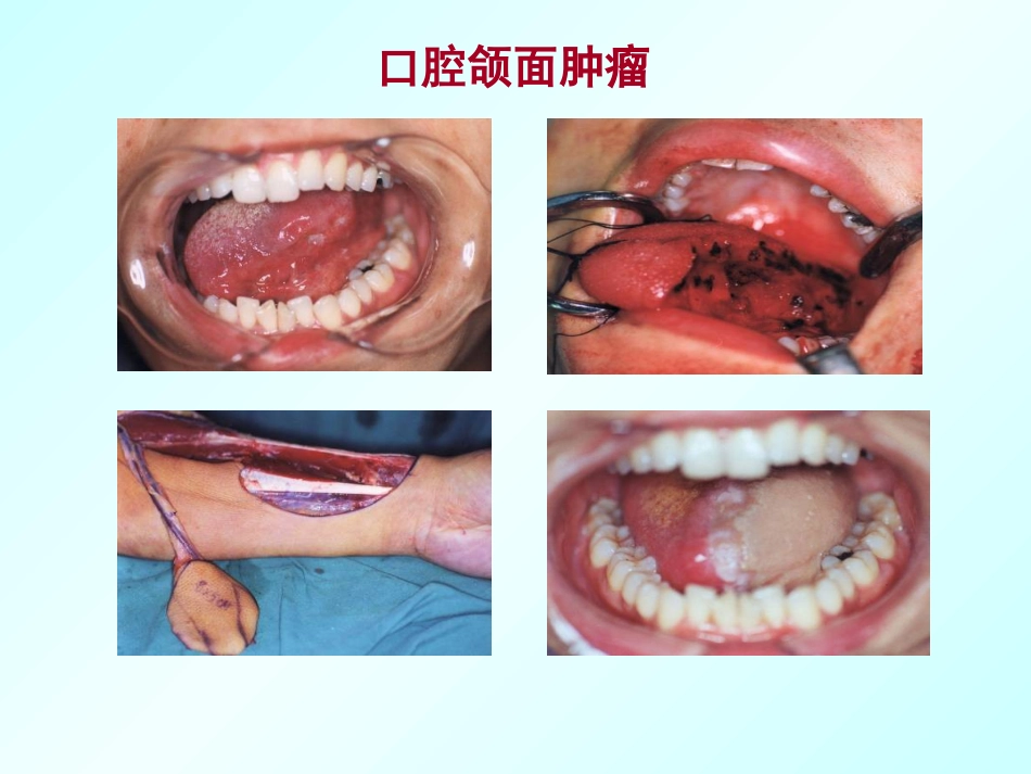 口腔颌面外科学绪论_第15页