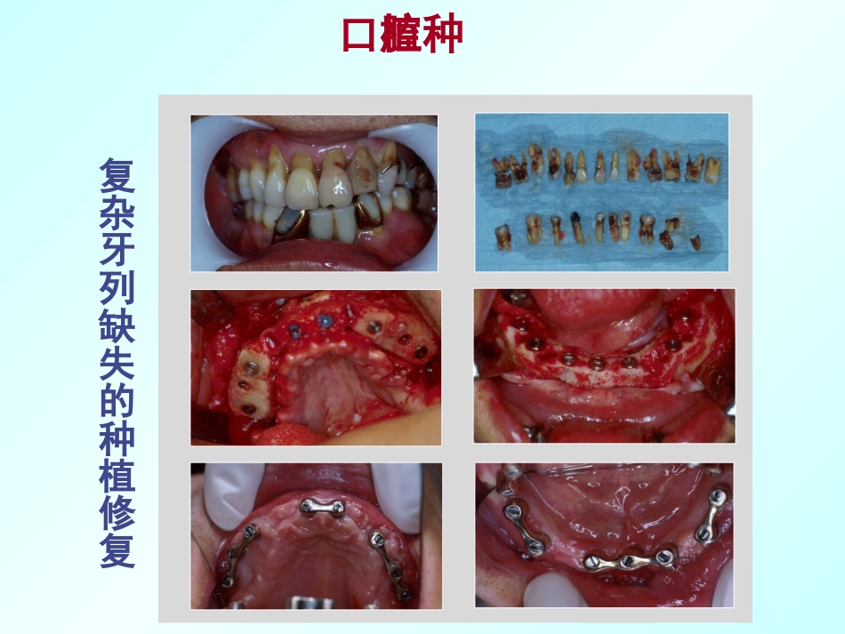 口腔颌面外科学绪论_第6页