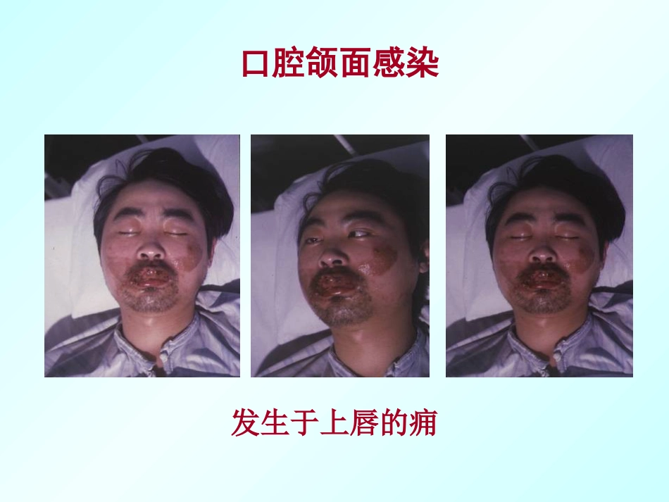 口腔颌面外科学绪论_第8页