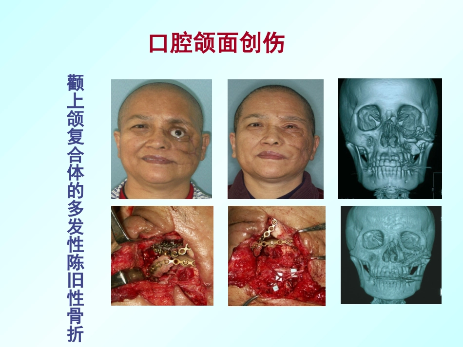 口腔颌面外科学绪论_第9页