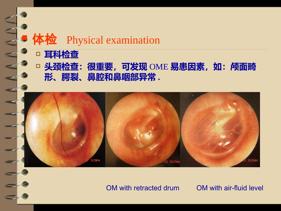 儿童分泌性中耳炎诊治_第10页