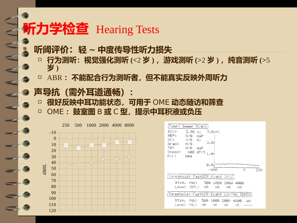 儿童分泌性中耳炎诊治_第11页
