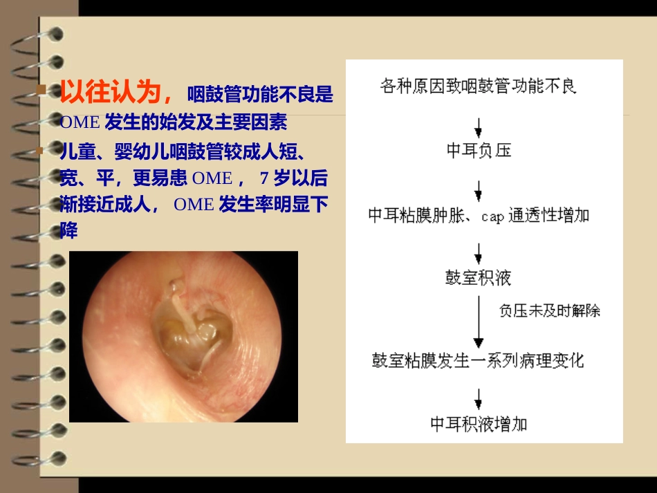 儿童分泌性中耳炎诊治_第6页
