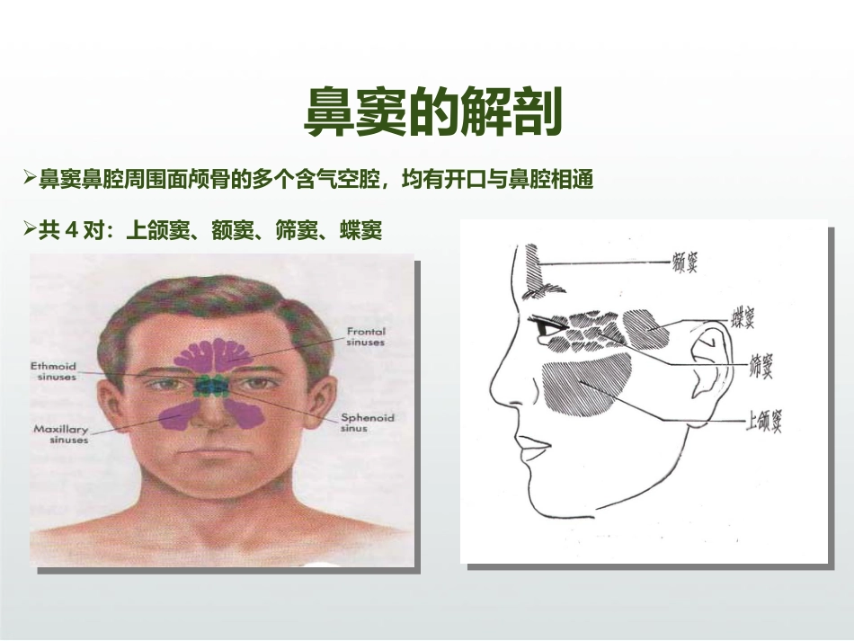 慢性鼻窦炎患者术后护理ppt_第5页